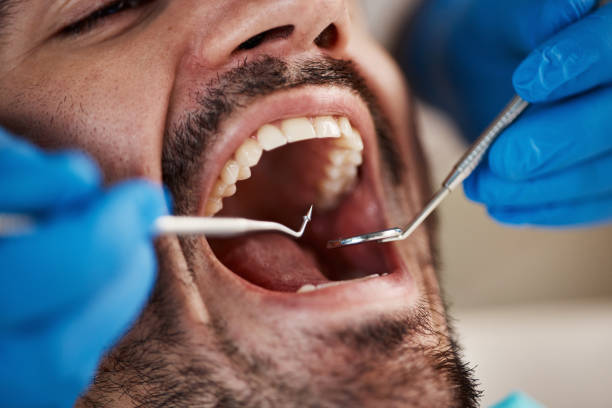 Best Emergency Cosmetic Dentistry (e.g., broken veneers) in Russells Point, OH