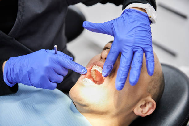 Best Broken or Chipped Tooth Repair in Russells Point, OH